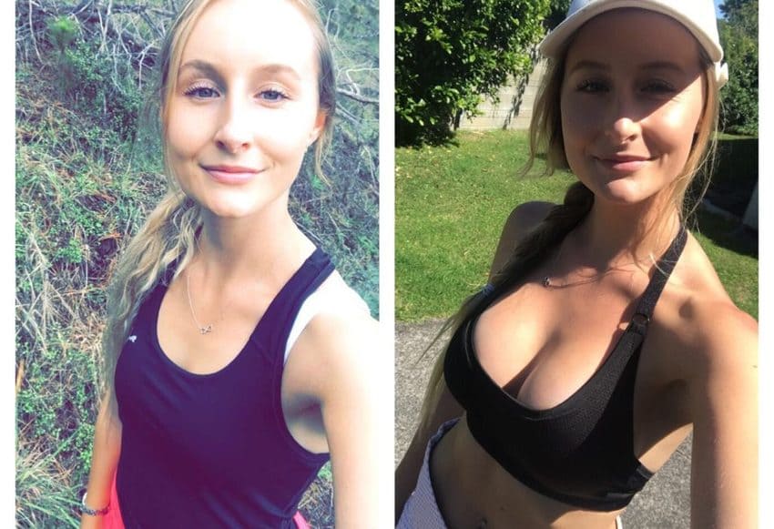 Före- och efterbilder av bröstförstoring