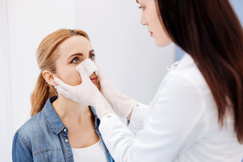 Patiente après une rhinoplastie
