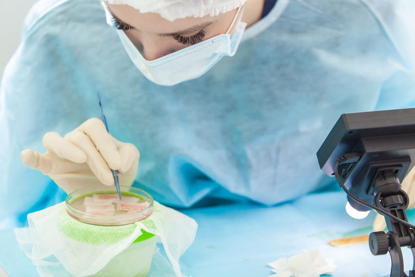 Chirurgien capillaire